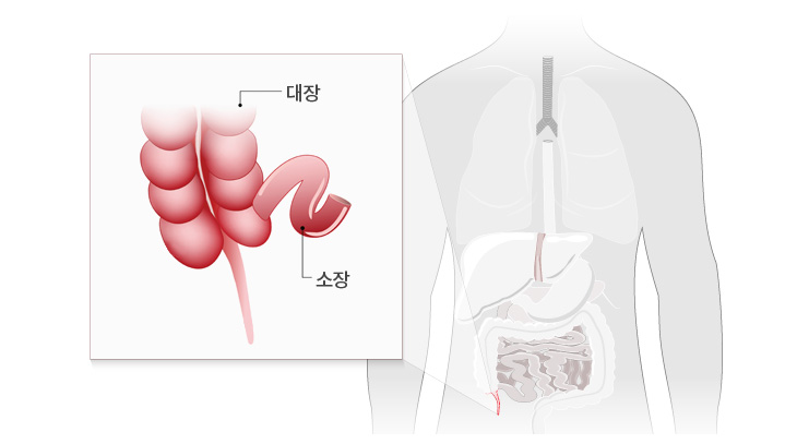 대장내시경이란? 호스 모양의 기구를 항문으로 삽입하여 장관 내부의 의심되는 병변이나 이상 유무를 내시경을 통해 간편하게 육안으로 관찰함으로써 정확한 진단 정보를 얻음은 물론 나아가 치료에까지 이용되는 가장 간단한 진단 방법입니다. 
